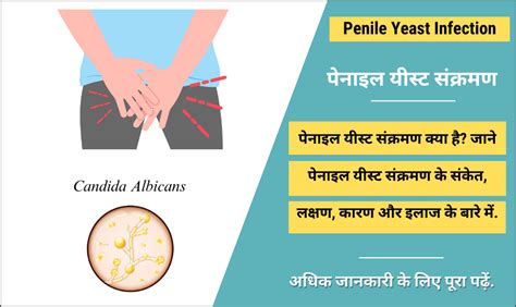 penile meaning in hindi|penis infection in hindi.